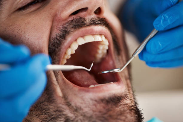 Best Cosmetic Emergency Dentistry in Glen Carbon, IL